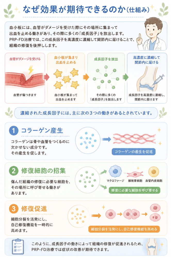 PRP-FD治療で効果が期待できる理由と成長因子の3つの働きを解説するイラスト画像