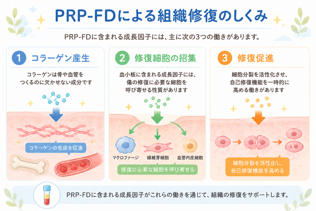 PRP-FDに含まれる成長因子による組織修復（コラーゲン産生・修復細胞の招集・修復促進）の仕組みの解説画像